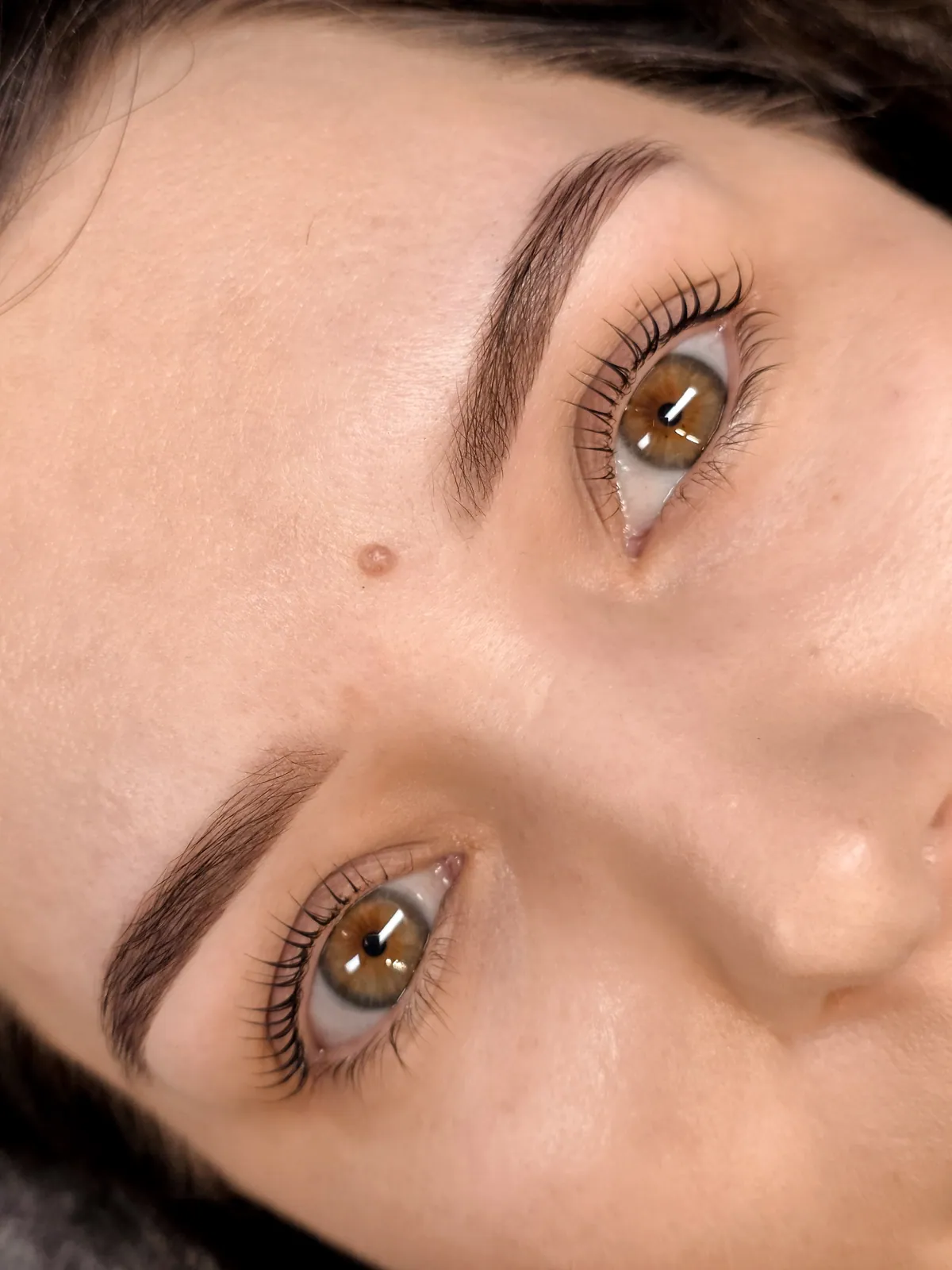 Augenbrauen nach dem Browlift
